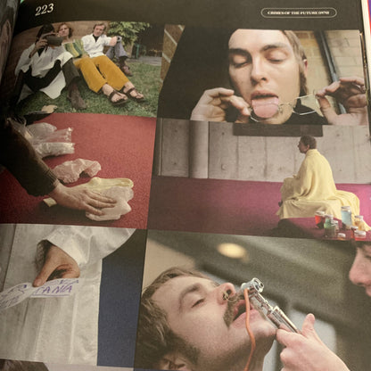 David Cronenberg — Clinical Trials